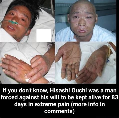 hisashi ouchi timeline|Hisashi Ouchi: The Man Who Survived History’s。